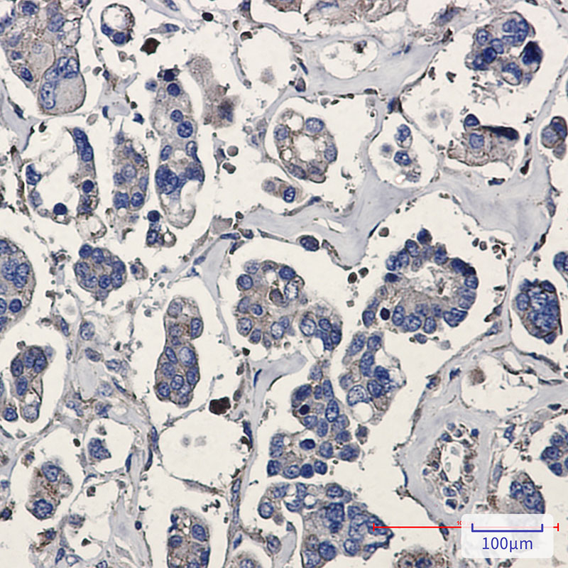 p16 ARC Rabbit mAb