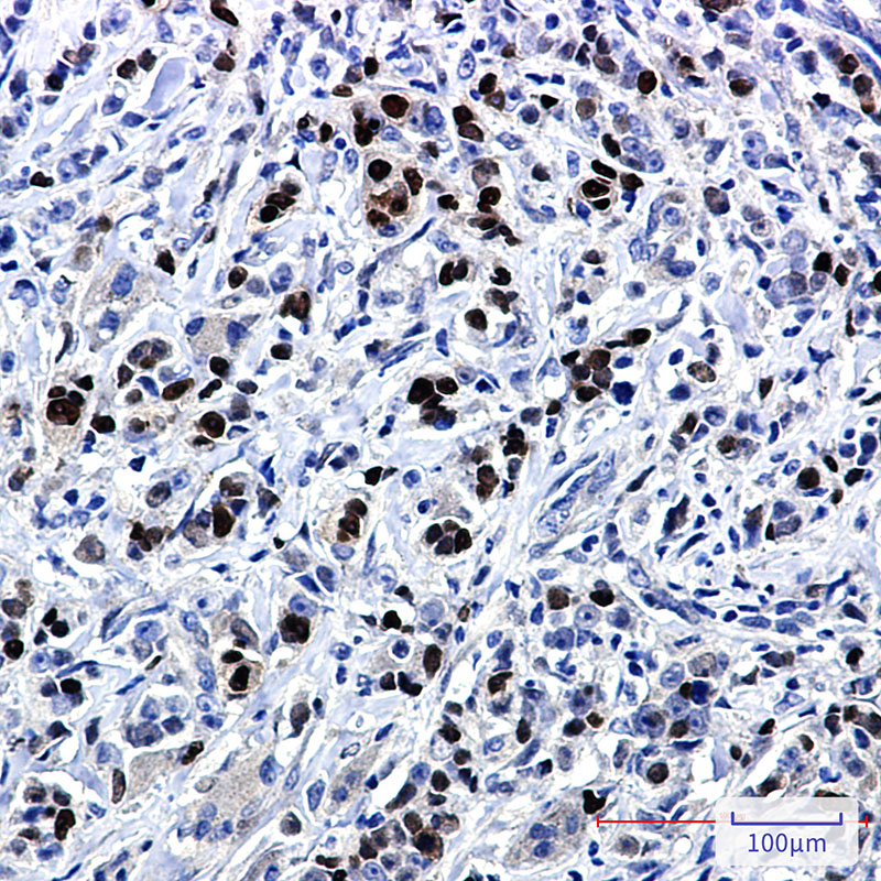 SOX9 Rabbit mAb