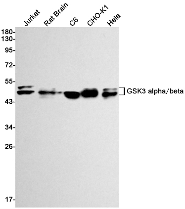 GSK3 alpha/beta Rabbit mAb