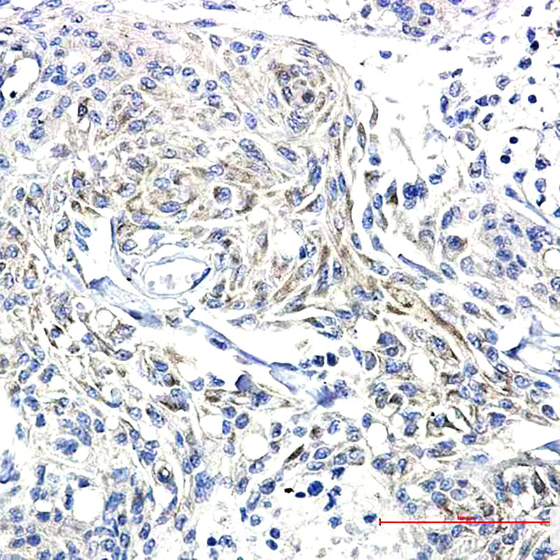 Phospho-Synapsin I (Ser9) Rabbit mAb