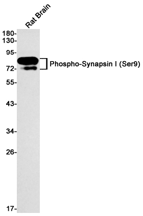 Phospho-Synapsin I (Ser9) Rabbit mAb