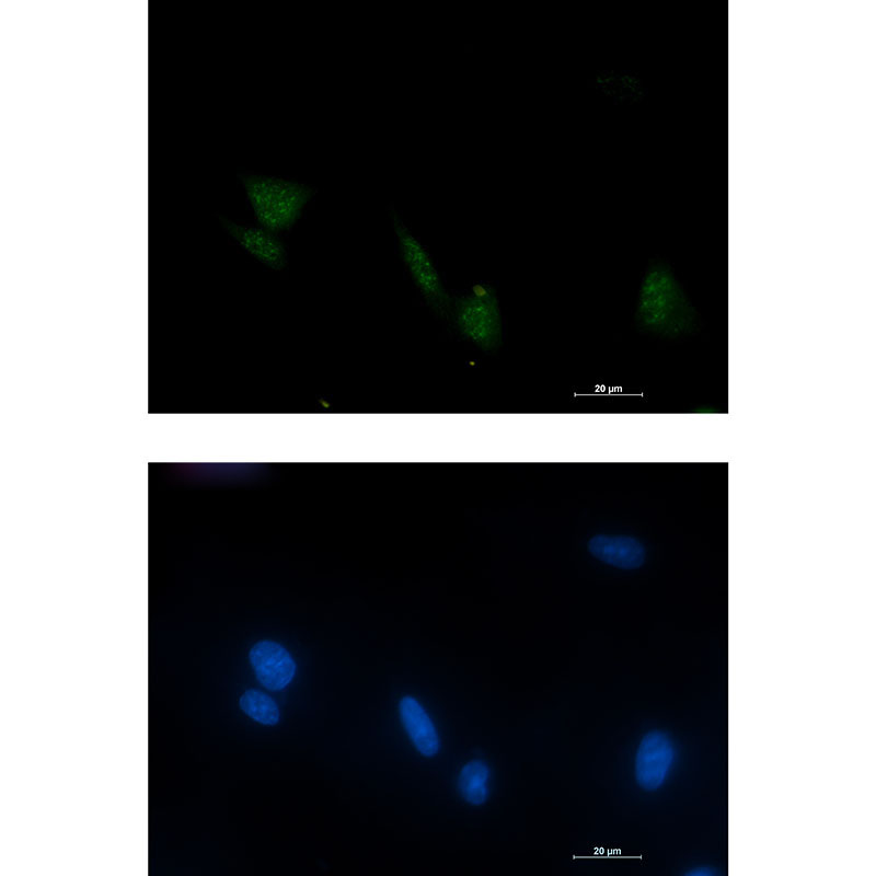 Phospho-RSK4 (Ser232) Rabbit mAb