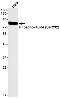 Phospho-RSK4 (Ser232) Rabbit mAb