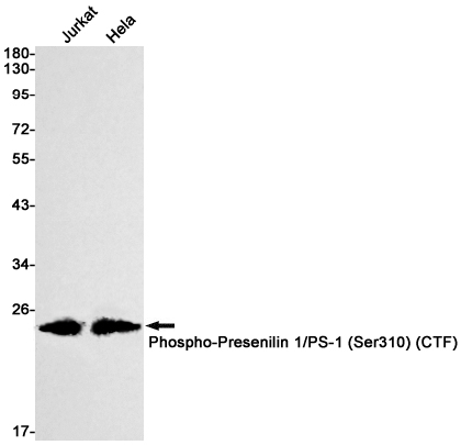 Phospho-Presenilin 1 (Ser310) Rabbit mAb