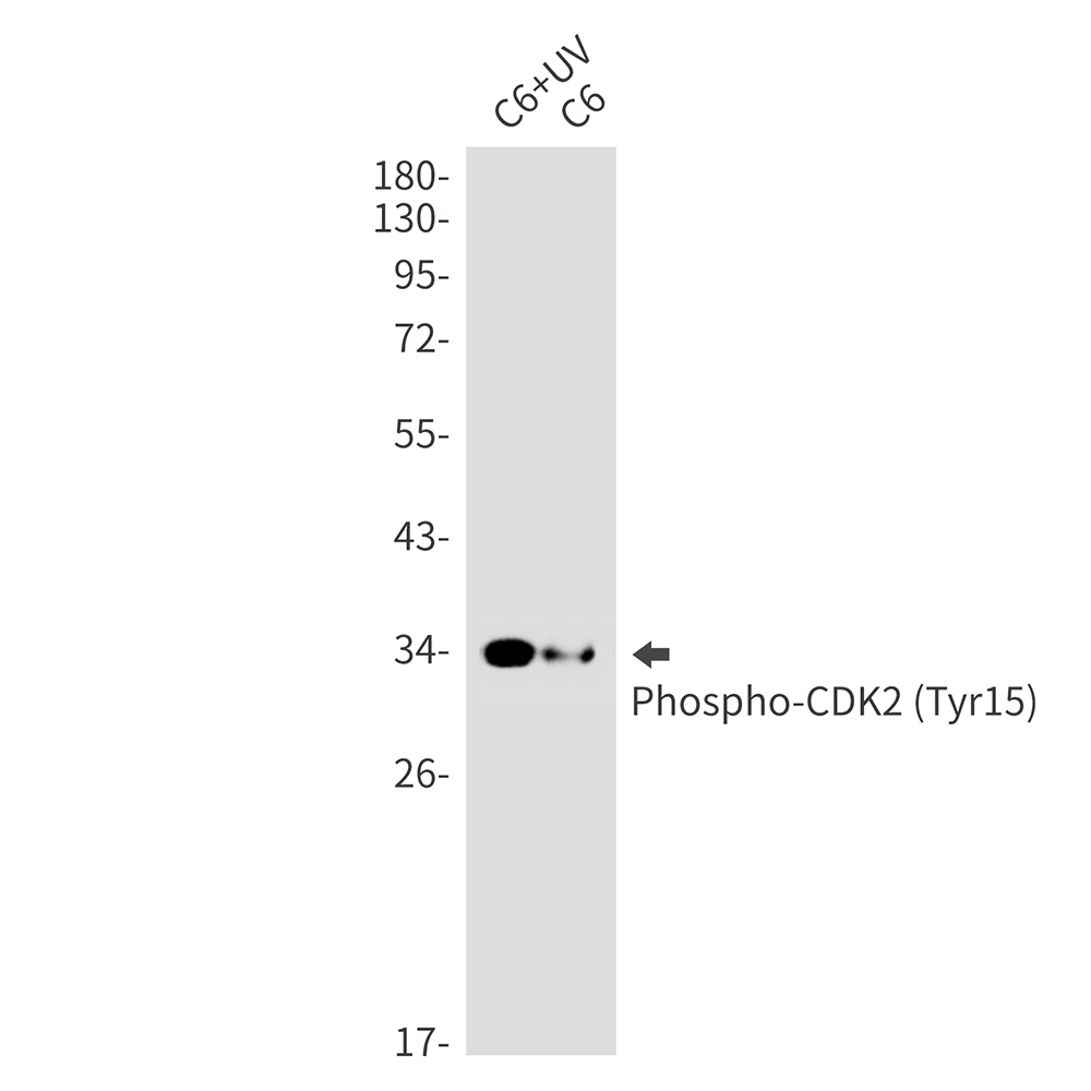 Phospho-CDK2 (Tyr15) Rabbit mAb