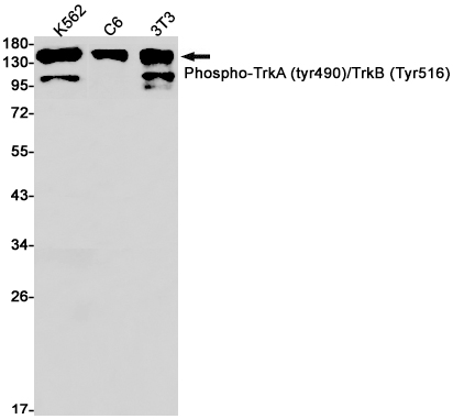 Phospho-TrkA/B (Tyr490/Tyr516) Rabbit mAb