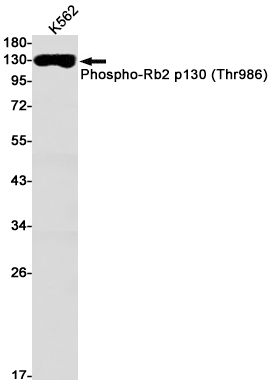 Phospho-Rb2 p130 (Thr986) Rabbit mAb