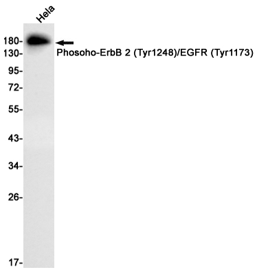 Phosoho-ErbB 2/EGFR (Tyr1248/Tyr1173) Rabbit mAb