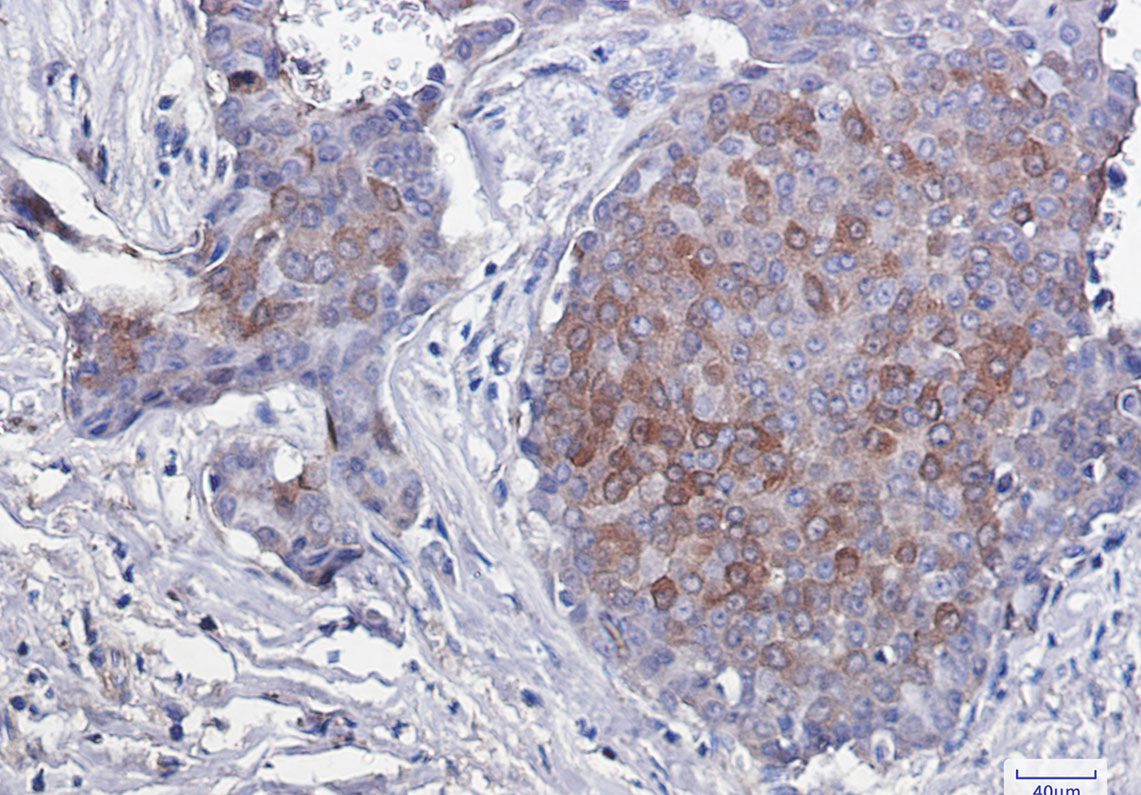 Phospho-4E BP1 (Thr46) Rabbit mAb