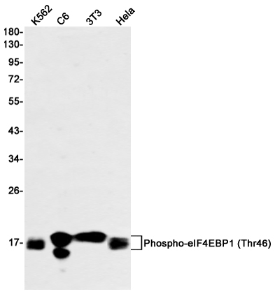 Phospho-4E BP1 (Thr46) Rabbit mAb