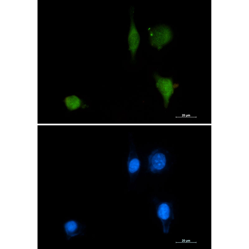 Phospho-delta 1 Catenin (Tyr228) Rabbit mAb