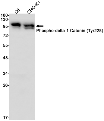 Phospho-delta 1 Catenin (Tyr228) Rabbit mAb