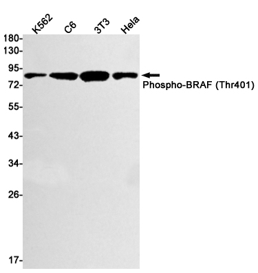 Phospho-BRAF (Thr401) Rabbit mAb