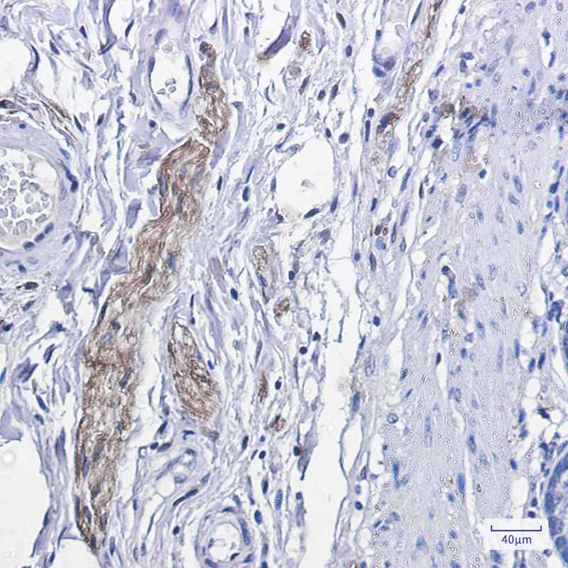 Phospho-PKC alpha (Thr638) Rabbit mAb