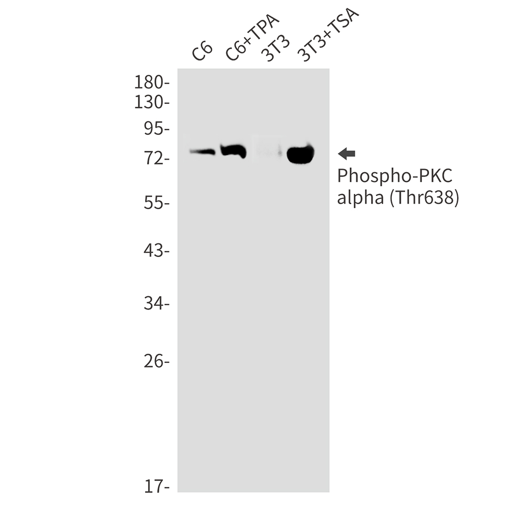 Phospho-PKC alpha (Thr638) Rabbit mAb