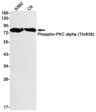 Phospho-PKC alpha (Thr638) Rabbit mAb