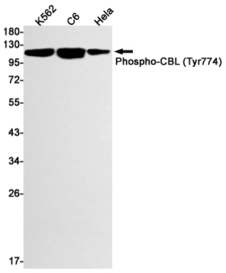 Phospho-CBL (Tyr774) Rabbit mAb