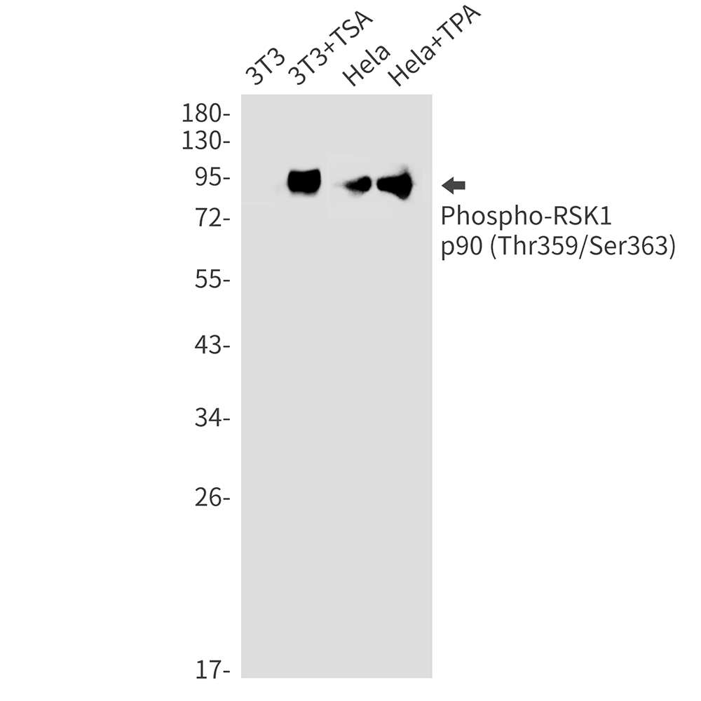 Phospho-RSK1 p90 (Thr359/Ser363) Rabbit mAb