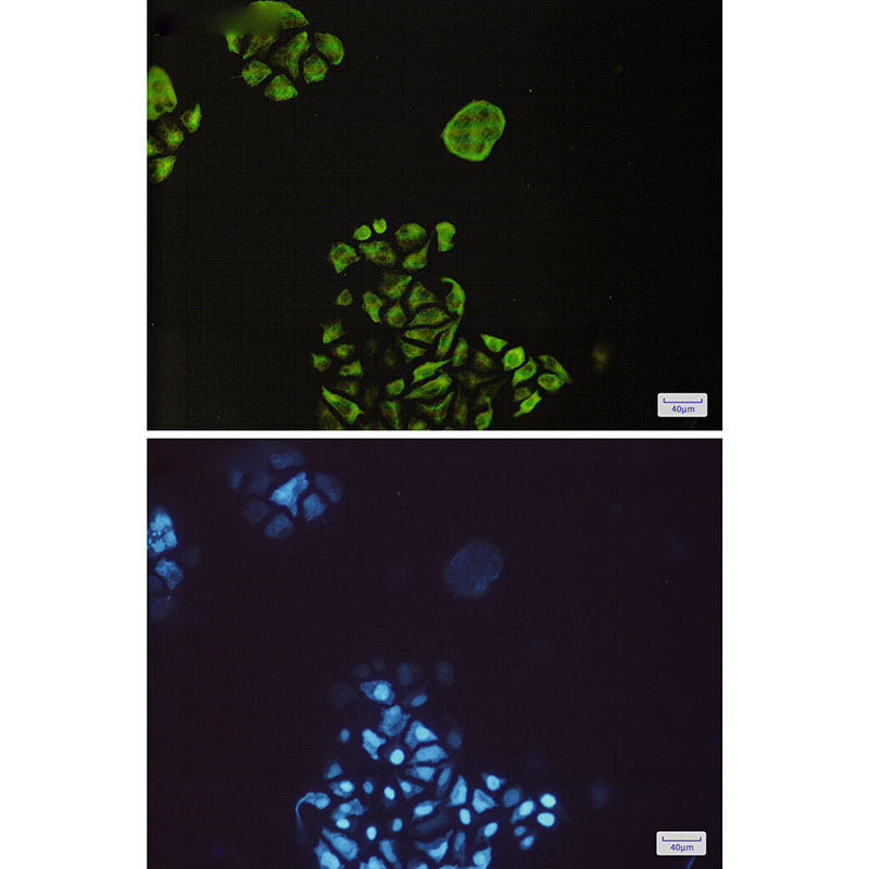 Phospho-GSK3 beta (Ser9) Rabbit mAb