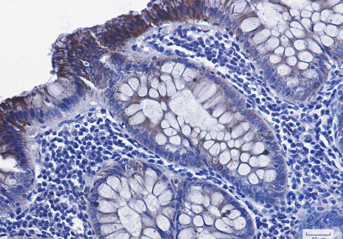 Phospho-GSK3 beta (Ser9) Rabbit mAb