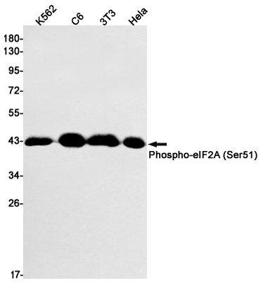 Phospho-eIF2A (Ser51) Rabbit mAb