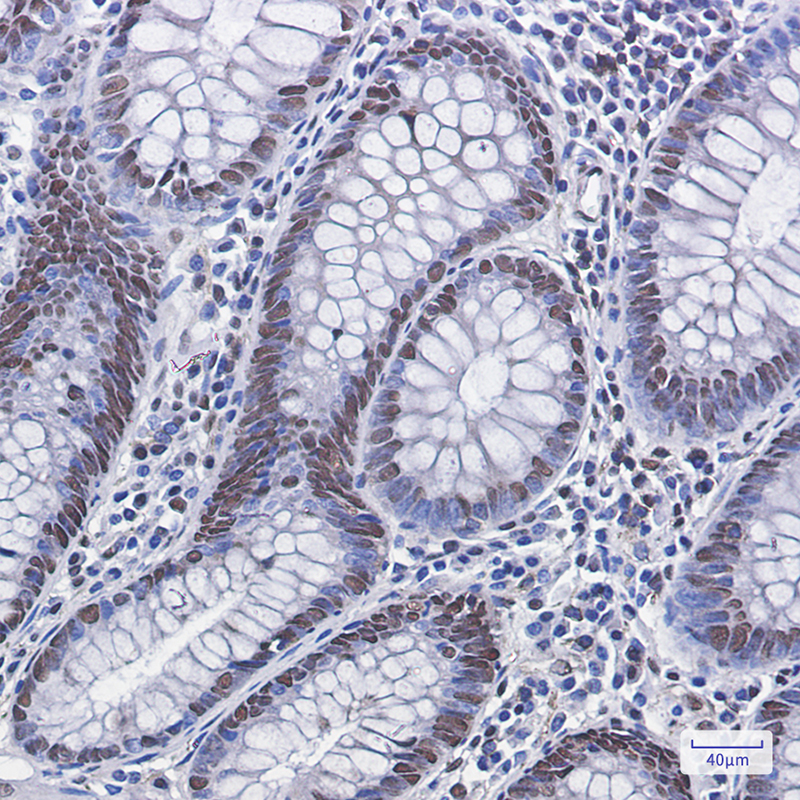 Phospho-MDM2 (Ser166) Rabbit mAb