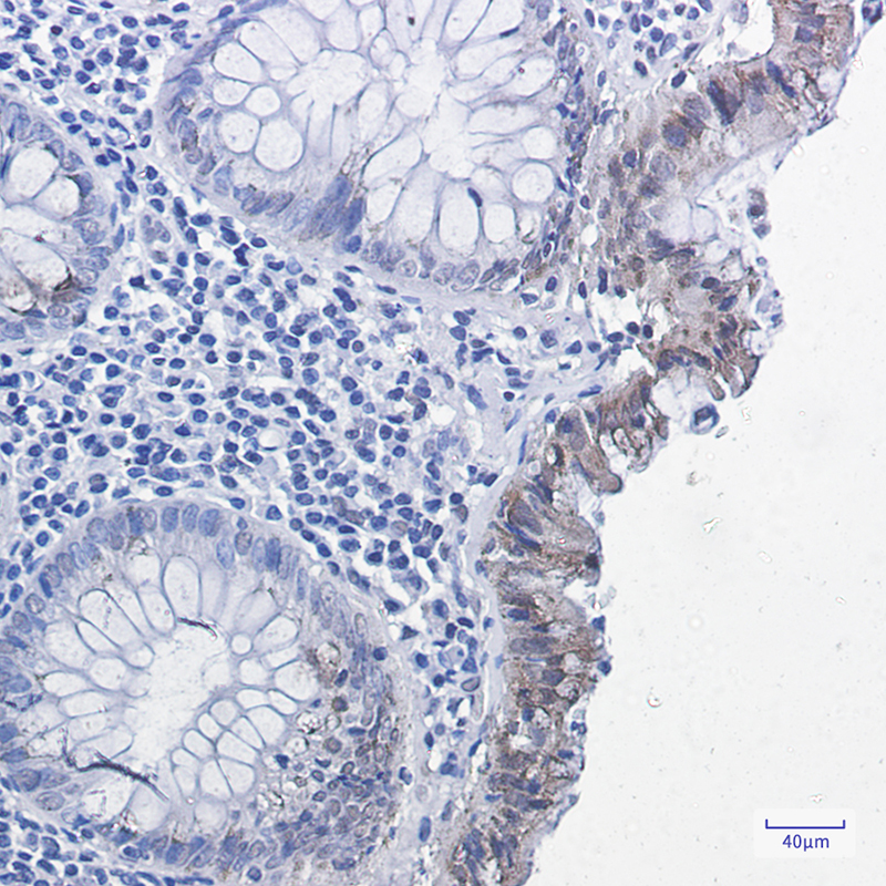 Phospho-Smad2 (Ser255) Rabbit mAb