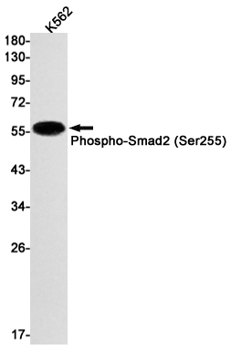 Phospho-Smad2 (Ser255) Rabbit mAb