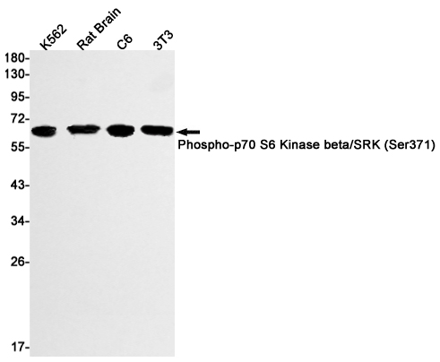 Phospho-S6K2 (Ser371) Rabbit mAb