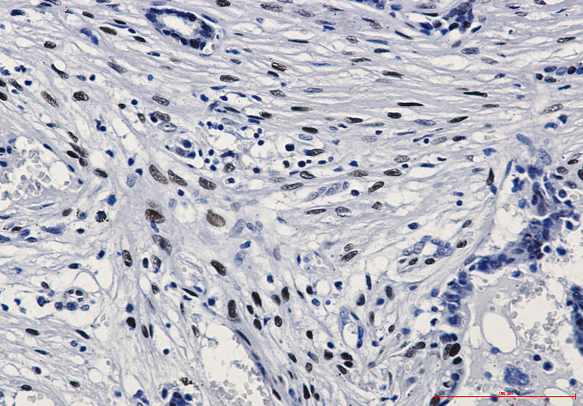 Phospho-c-Jun (Ser63) Rabbit mAb