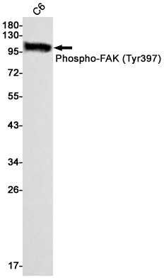 Phospho-FAK (Tyr397) Rabbit mAb