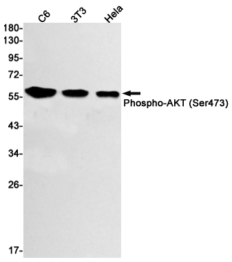 Phospho-AKT (Ser473) Rabbit mAb