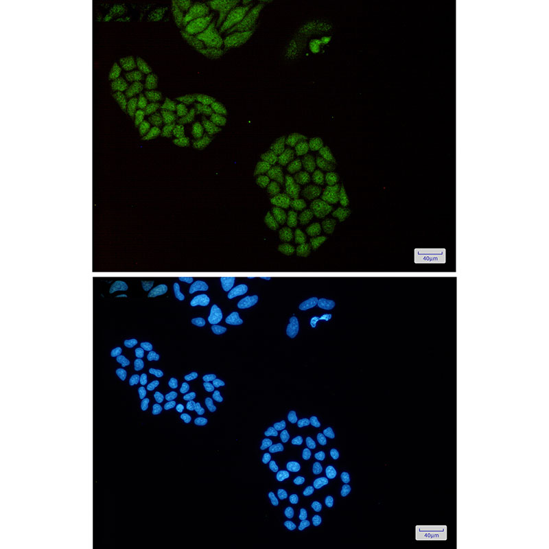 ENO1 Rabbit mAb