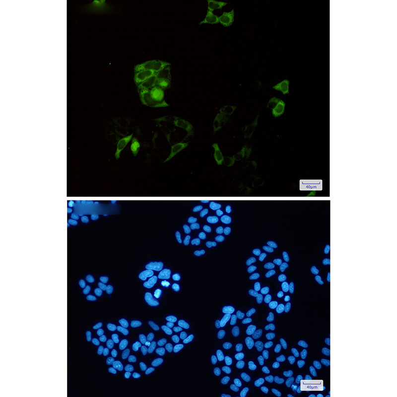 Cyclin B1 Rabbit mAb