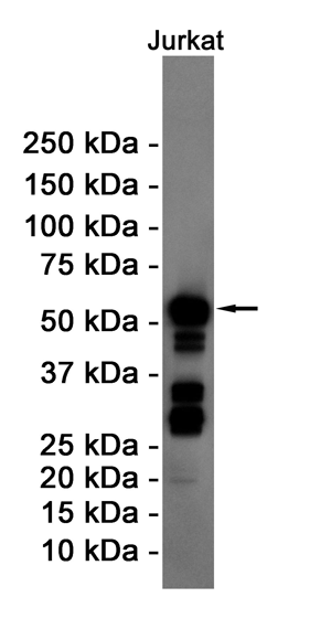 Cyclin B1 Rabbit mAb