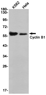 Cyclin B1 Rabbit mAb