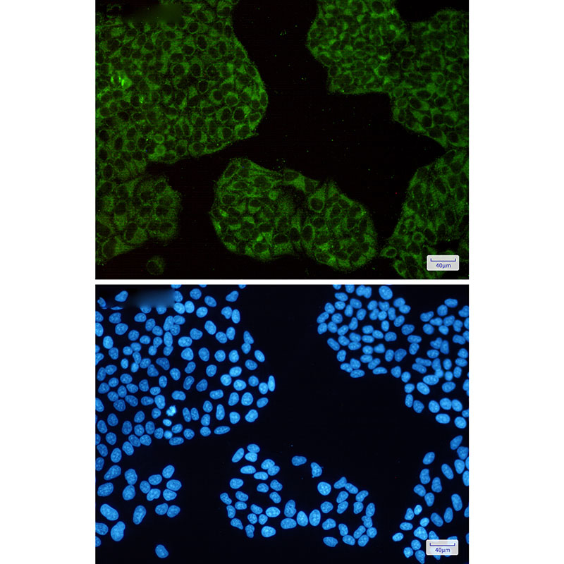 Ferritin Heavy Chain Rabbit mAb