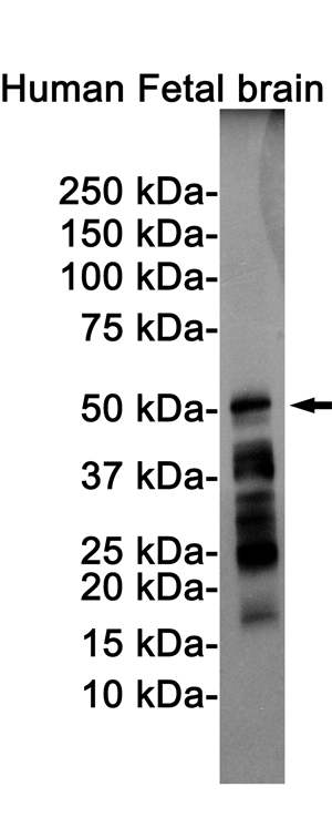 Phospho-Tau (Ser198) Rabbit mAb