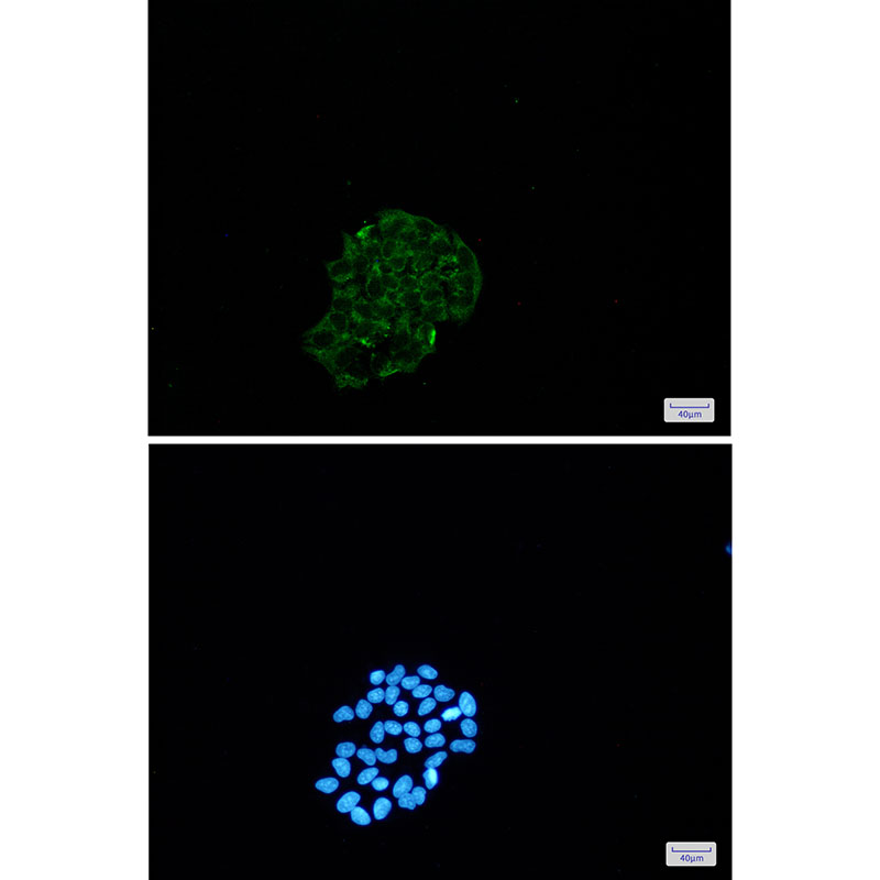 BNIP3 Rabbit mAb