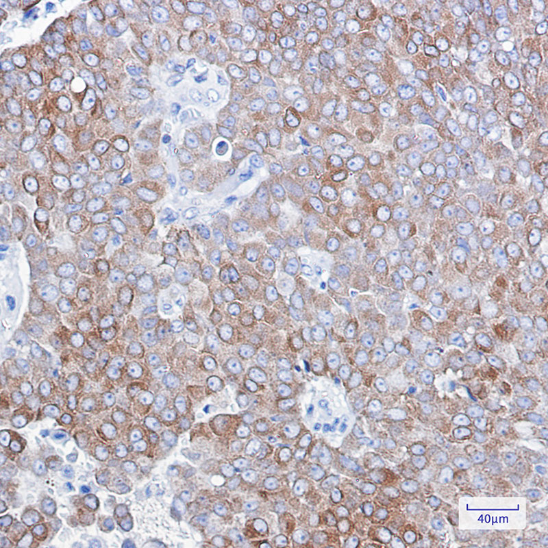 Bcl2 Rabbit mAb