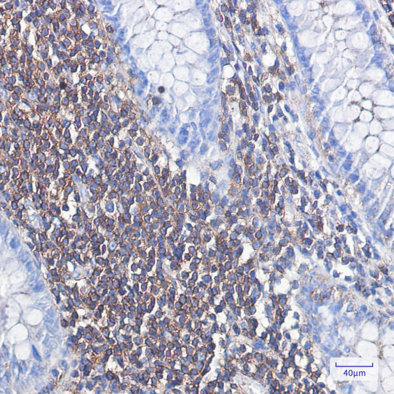 alpha Skeletal Muscle Actin Rabbit mAb