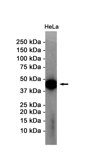 alpha Skeletal Muscle Actin Rabbit mAb