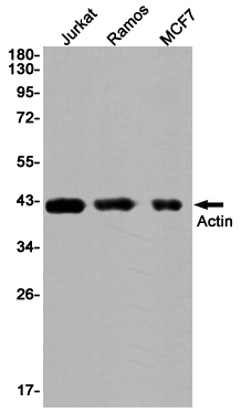 alpha Skeletal Muscle Actin Rabbit mAb