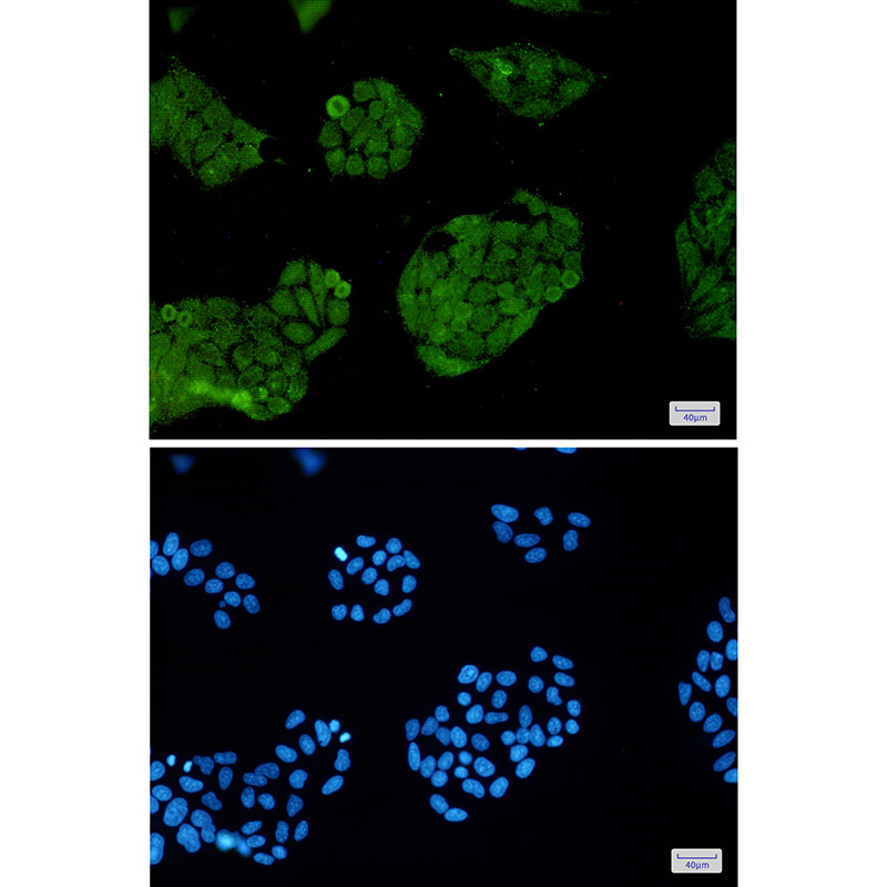 FOXO1 Rabbit mAb