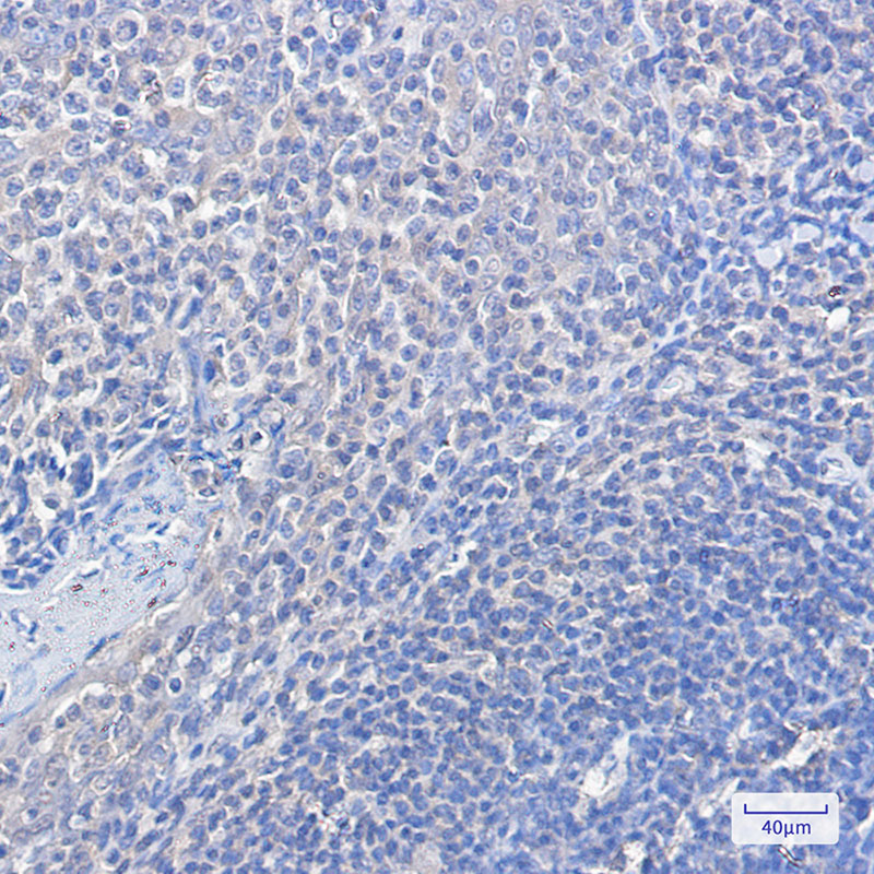 FOXO1 Rabbit mAb