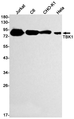 TBK1 Rabbit mAb