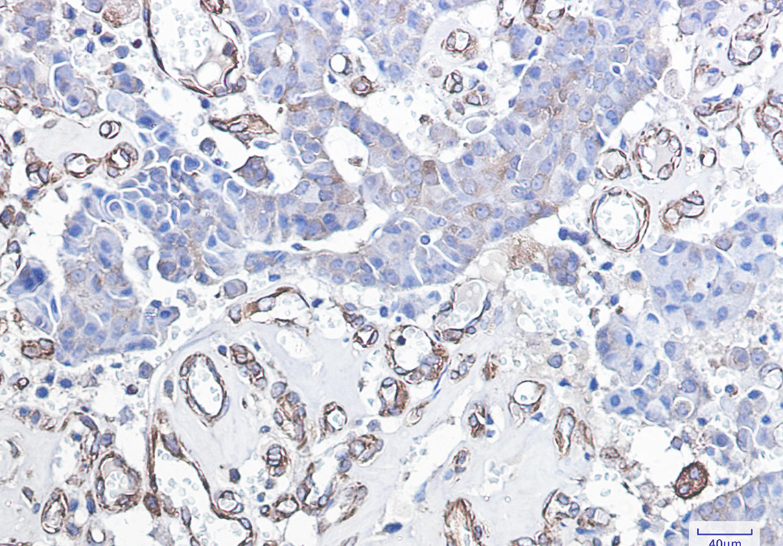 DDIT3 Rabbit mAb