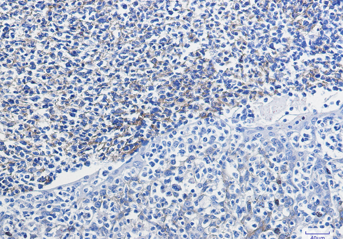 VCAM1 Rabbit mAb