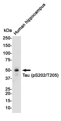 Phospho-Tau (Ser202/Thr205) Rabbit mAb