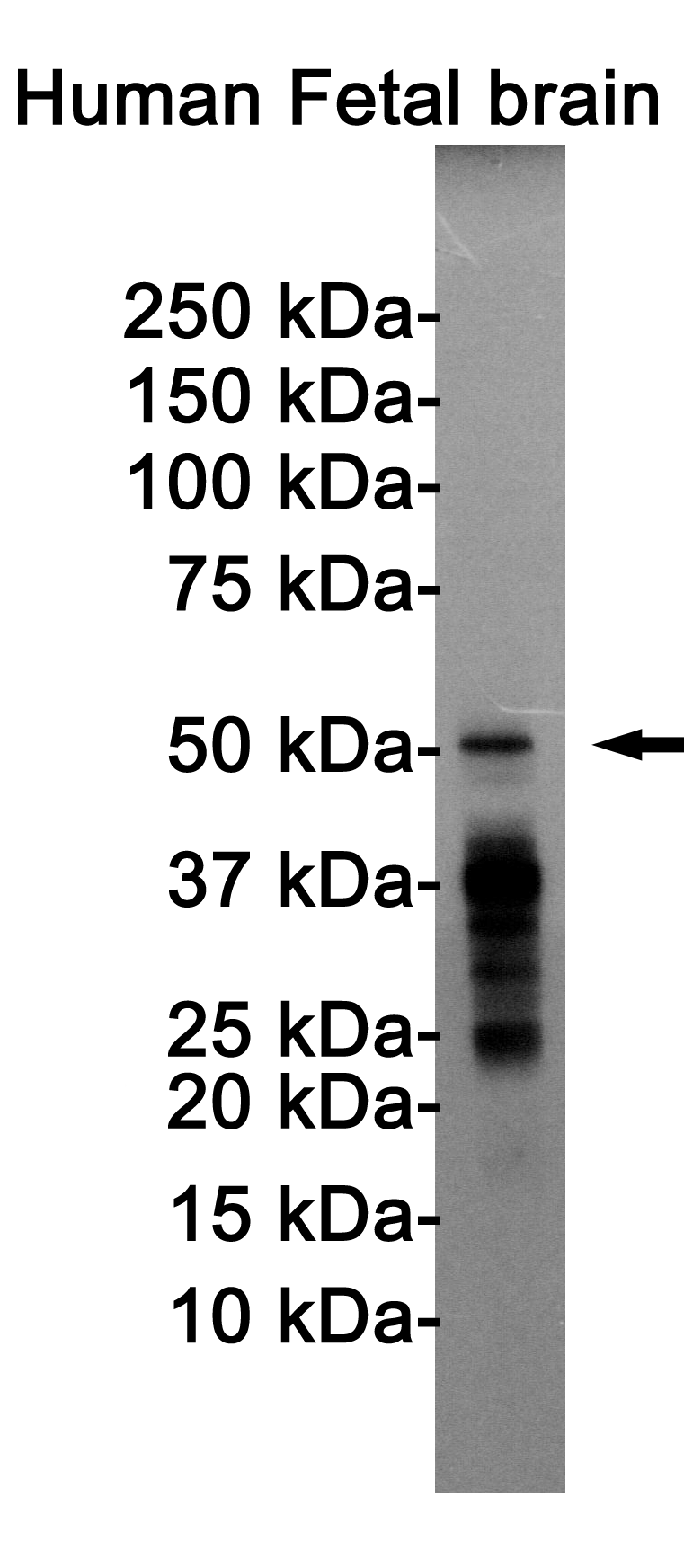 Phospho-Tau (Thr205) Rabbit mAb